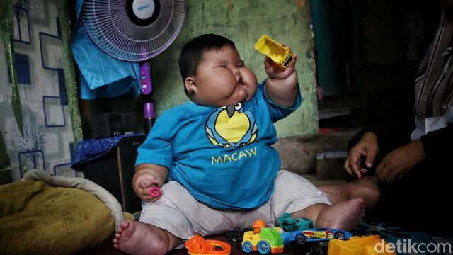 Bayi Obesitas 27 Kg
